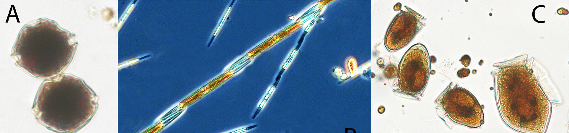 Three photos of microalgae that cause shellfish poisoning